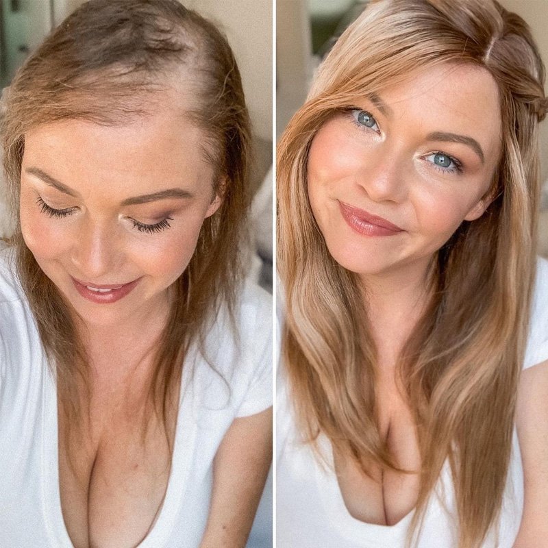 7" X 8" Upgrade Corutney Mono Top Human Hair Topper | In Almond Frost & Light Permafrost