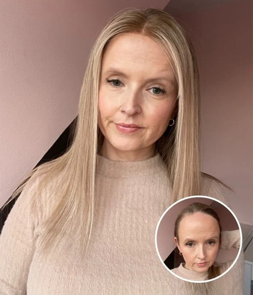 1511-harper-ultra-breathable-full-lace-human-hair-hairline-topper-with-halo-wire-14