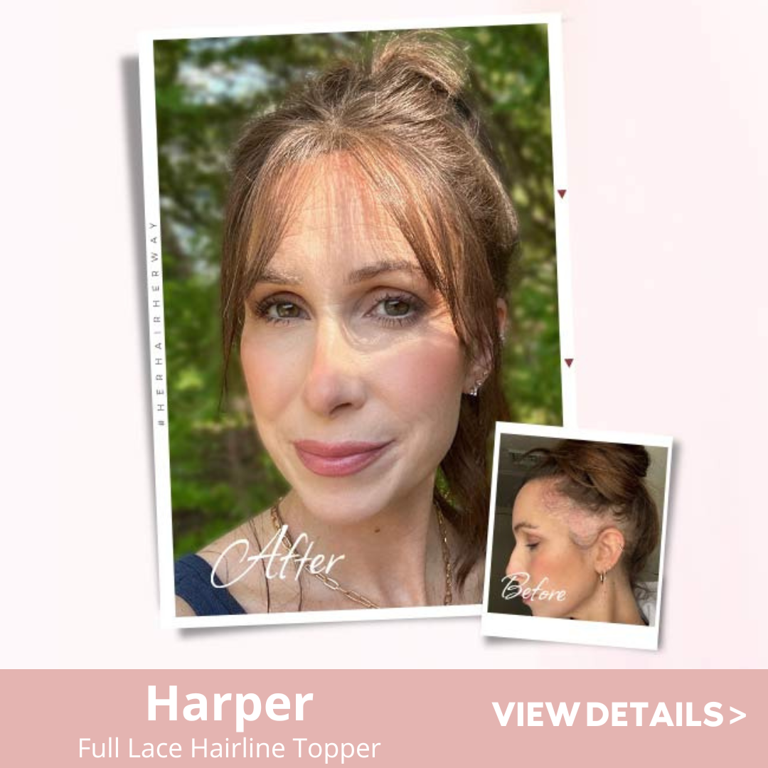 UniWigs hairline topper