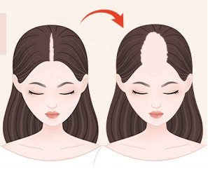 4 SIGNS YOU NEED A NEW TOPPER