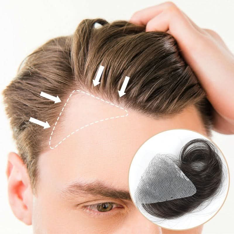 TU2203 temple hair patch for men with bald temples