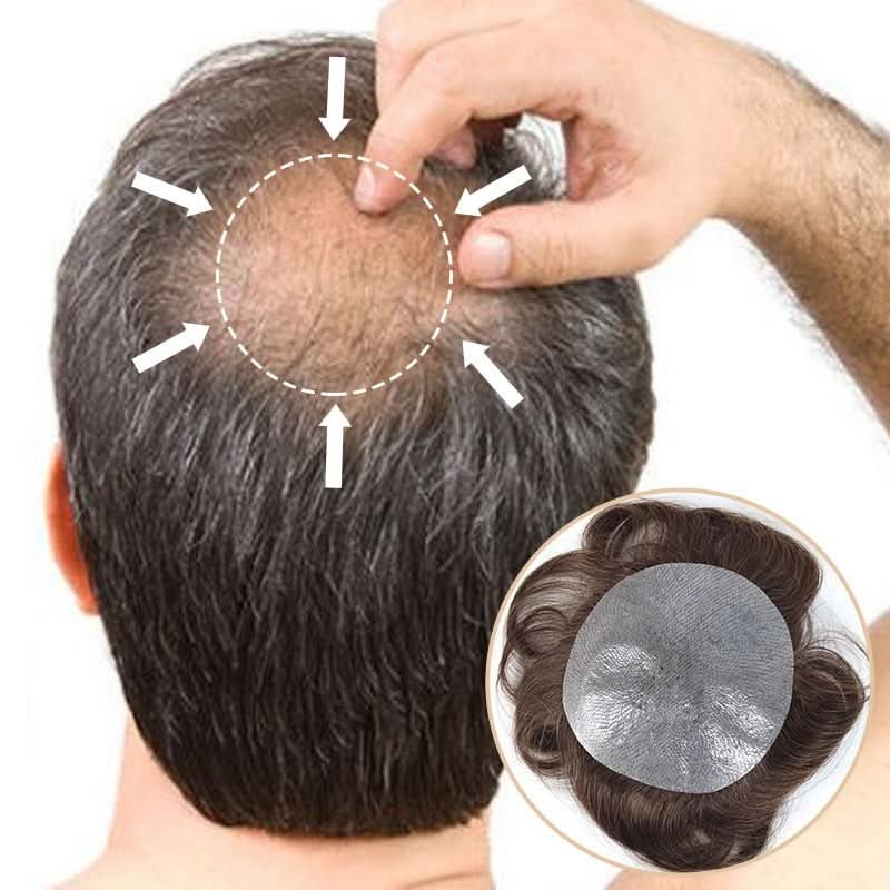 TU2204 crown hair patch for men with thinning crown