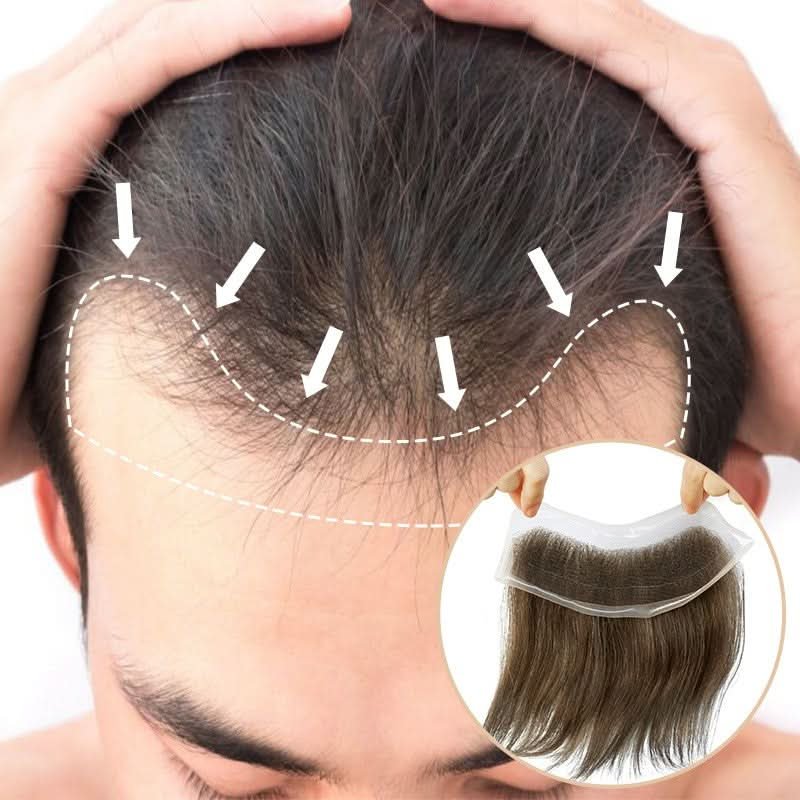 TU2206 lace hair patch for men to cover receding hairline