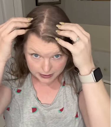 Widow’s Peak