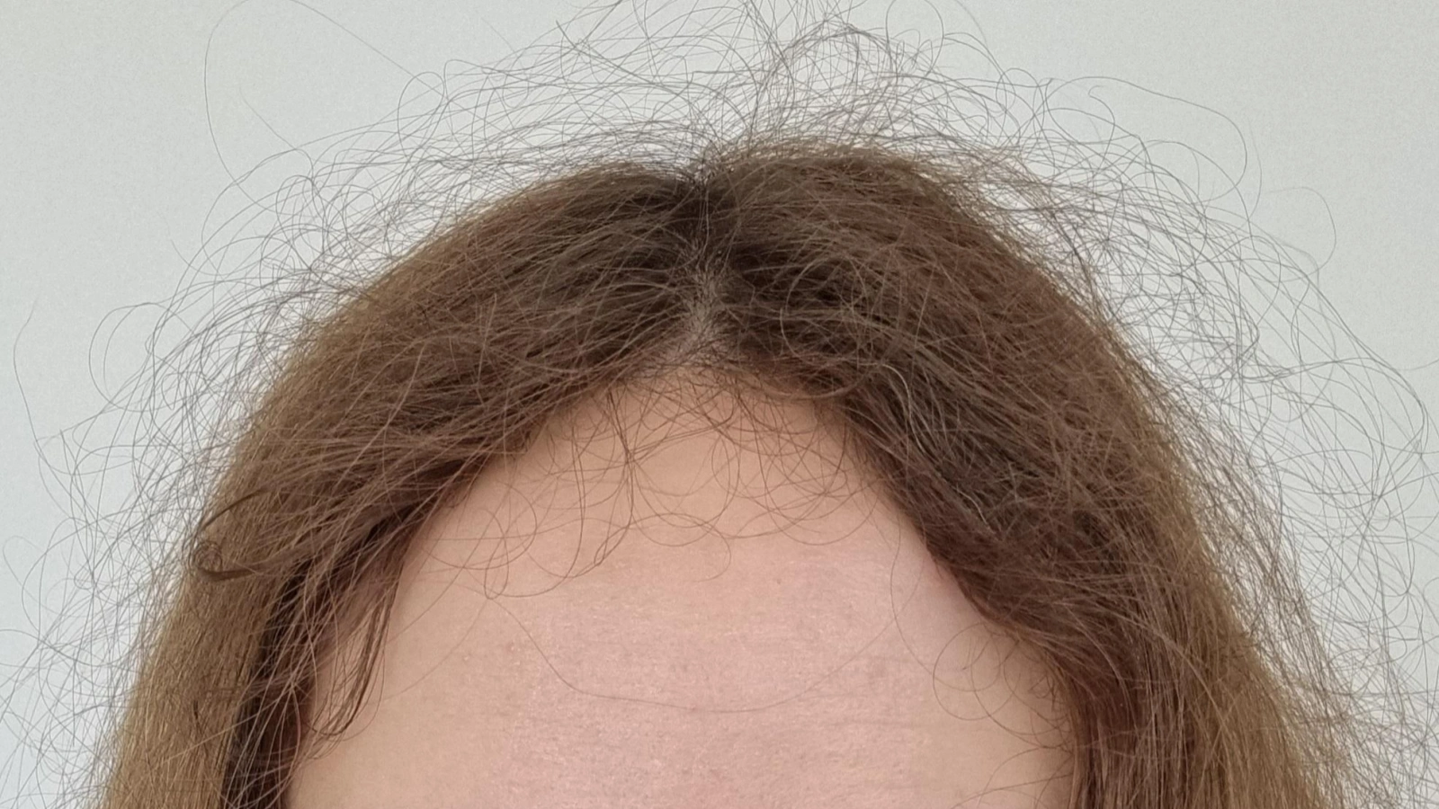 frizzy hair