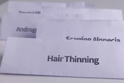 hair thinning