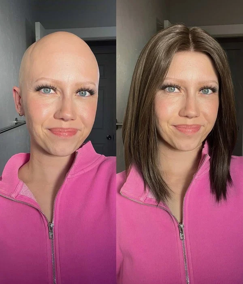 amelie-mono-top-lace-front-remy-human-hair-wig-100-hand-tied-medical-grade (2)