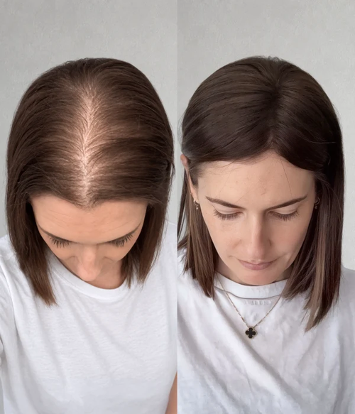 closed-lace-65-x-7-airy-elegance-ultra-breathable-human-hair-topper-european-hair-low-density
