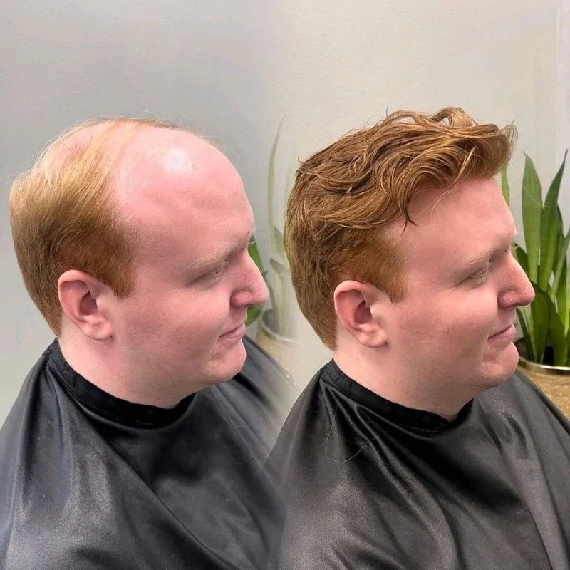 Custom Hair Systems