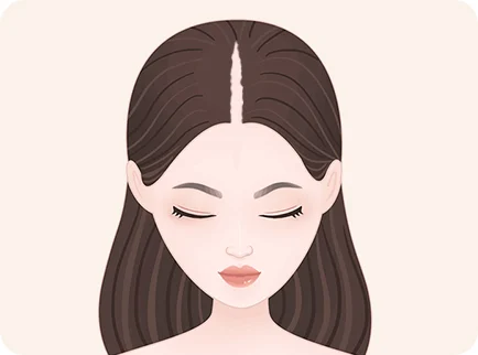 new-to-hair-toppers21