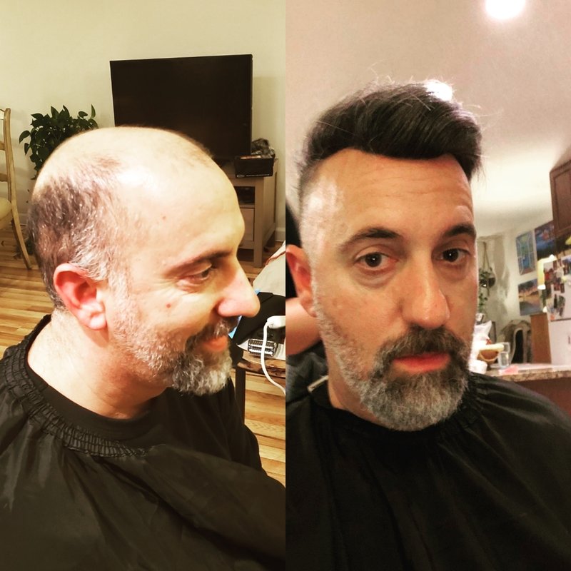 How to Find Toupee Installation Near Me