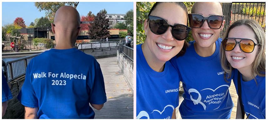walk for alopecia