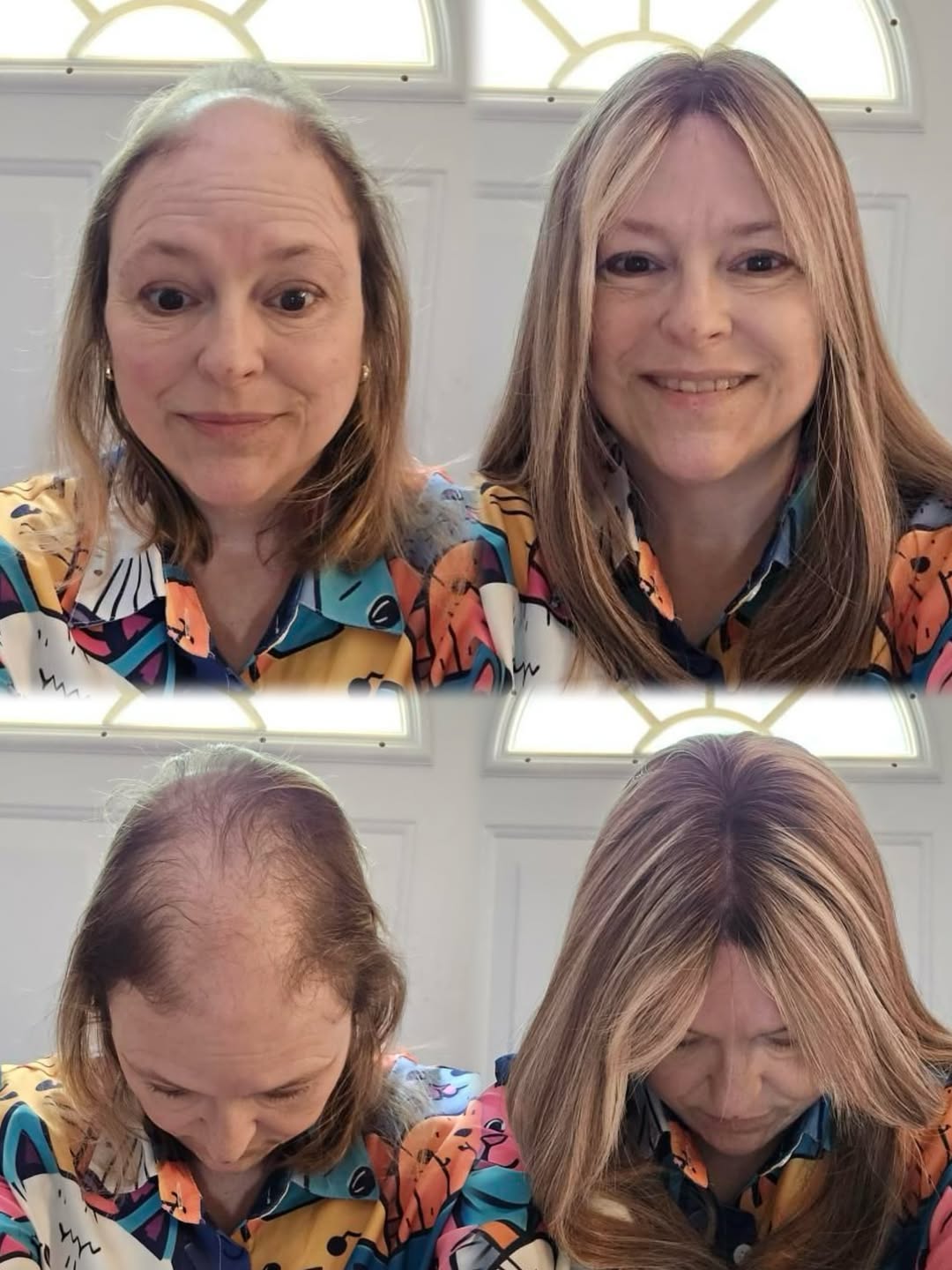 I finally recognize myself again. Breeze lace front topper