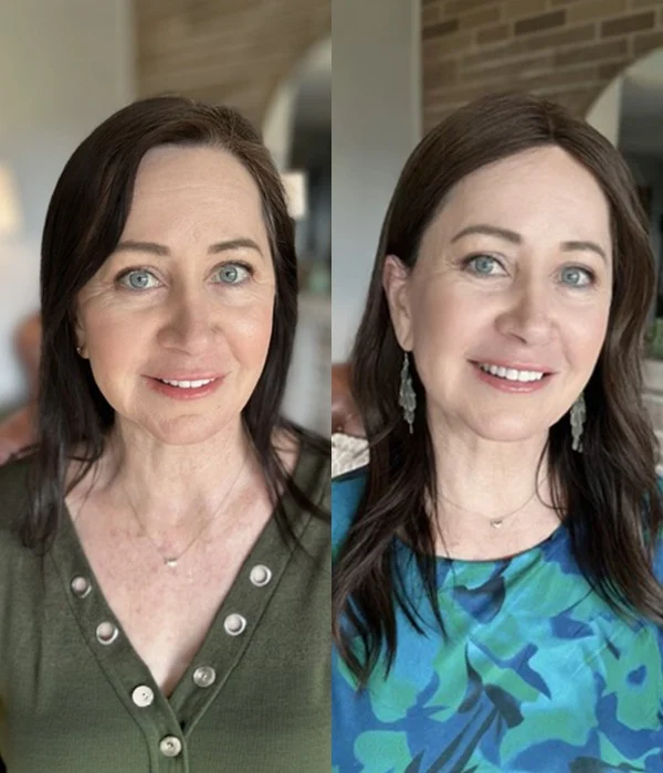 Upgrade Clair human hair, hair topper