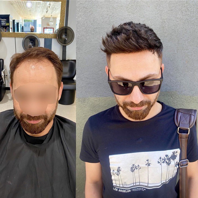hairsystemformen