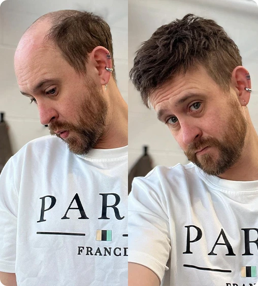use hair system