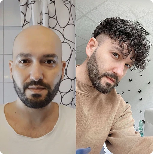 toupee for men